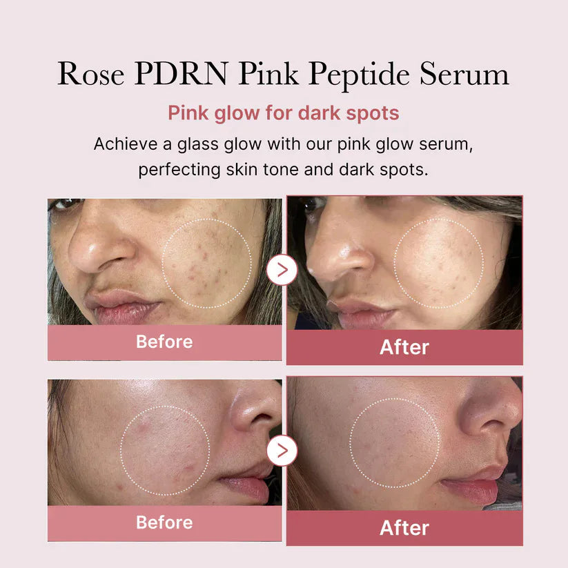 Niacinamide PDRN Pink Salmon Peptide Serum – Targets Dark Spots & Uneven Tone Hydrates Firms Smooths Fine Lines Daily Radiance