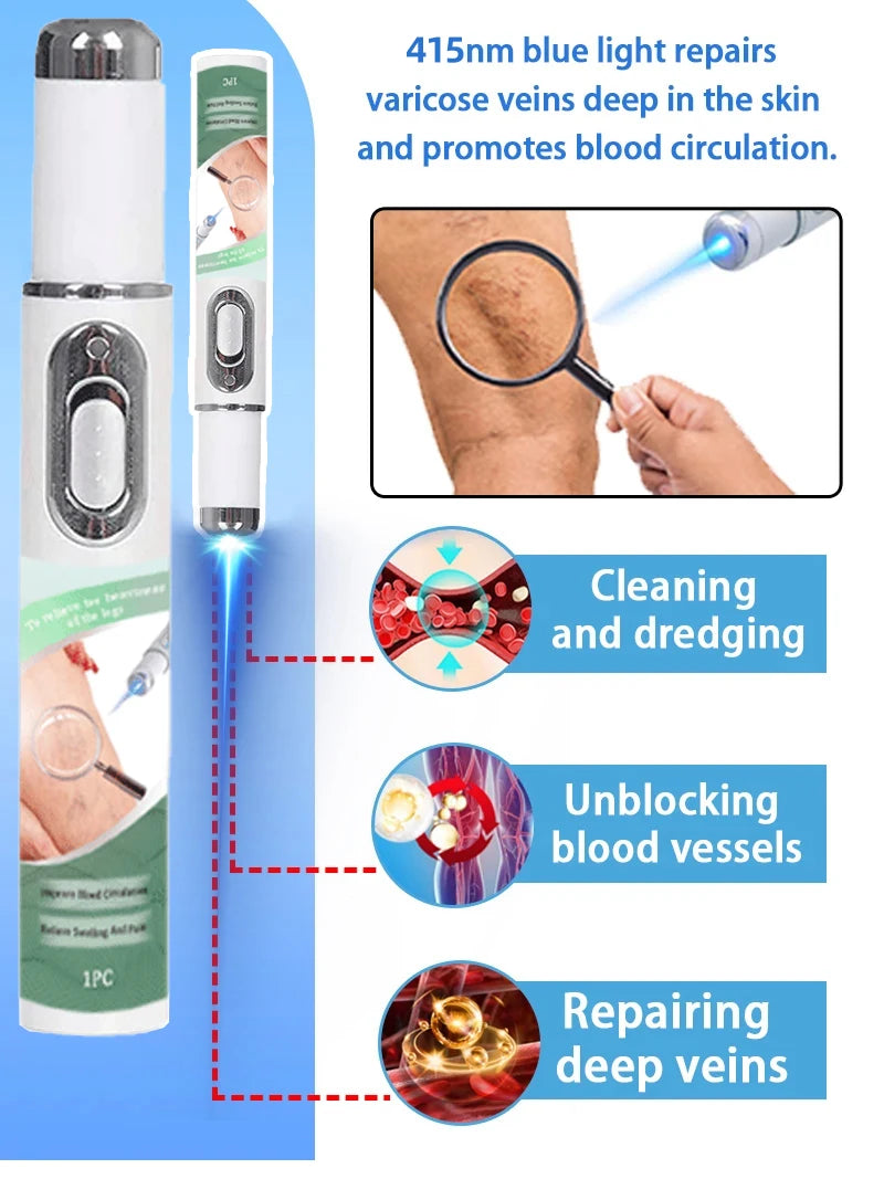 Blue Light Therapy Pen for Leg Vein Care - Portable Wellness Device Back Massage Instrument Tidesmit