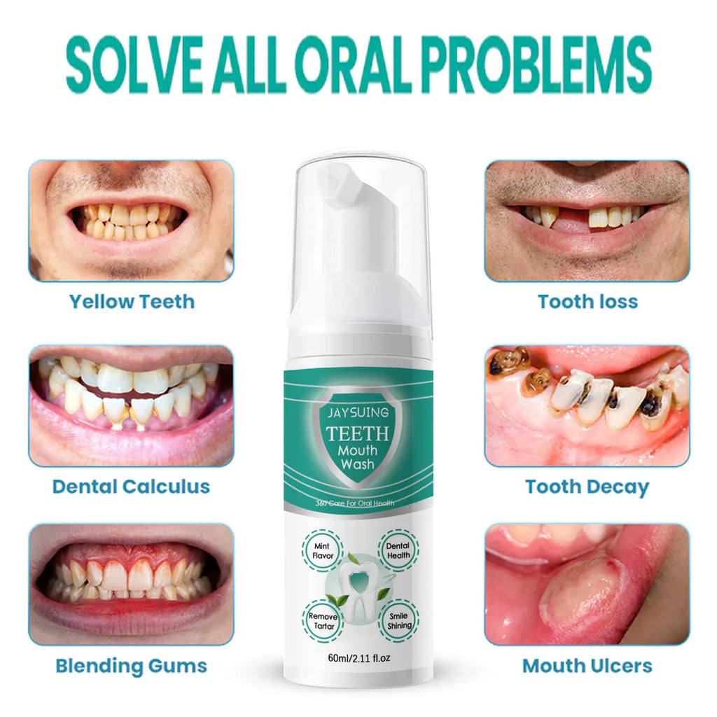 Tidesmit yellow teeth cleaning whitening mousse for plaque removal and dental stain repair