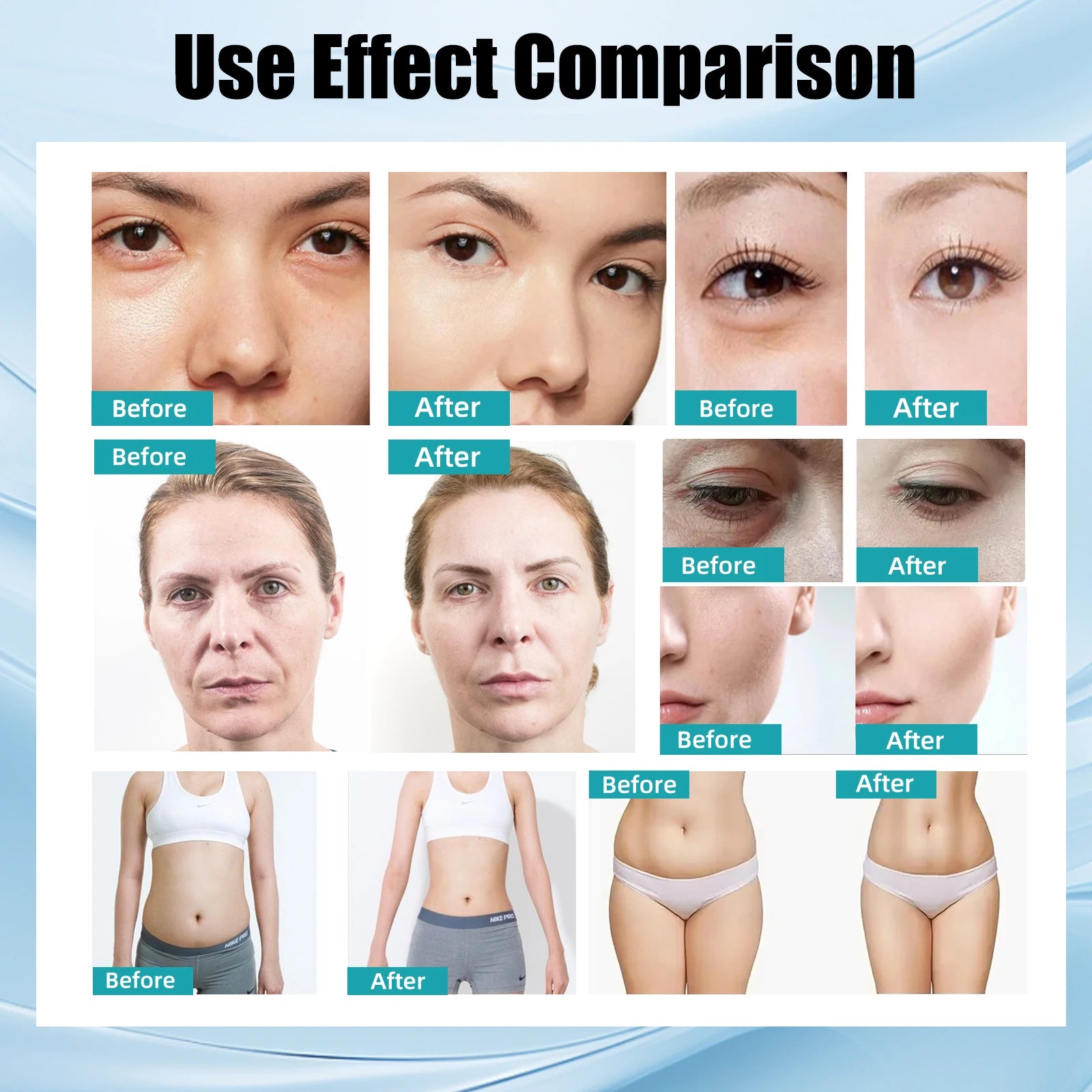 Before and after comparison of 4-in-1 RF, ultrasound, and EMS beauty device for facial lifting and body slimming.