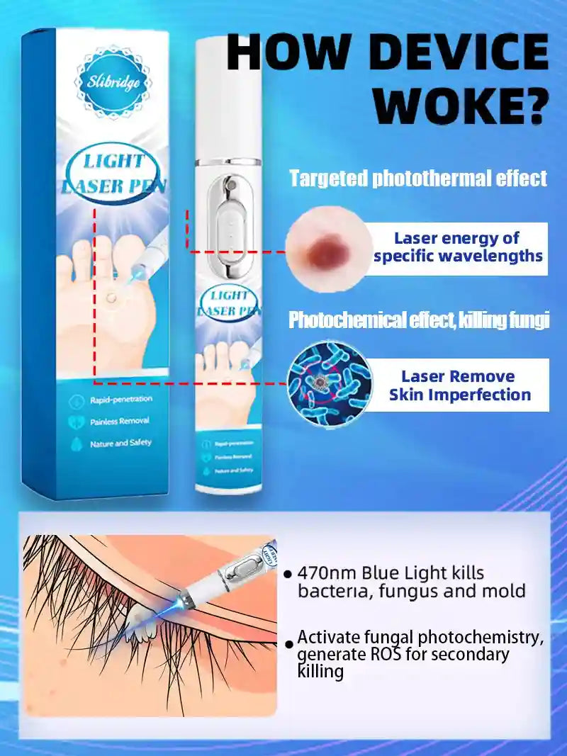 Blue Light Wart Removal Pen | Targeted Skin Care Device | Tidesmit Lip Care Tidesmit