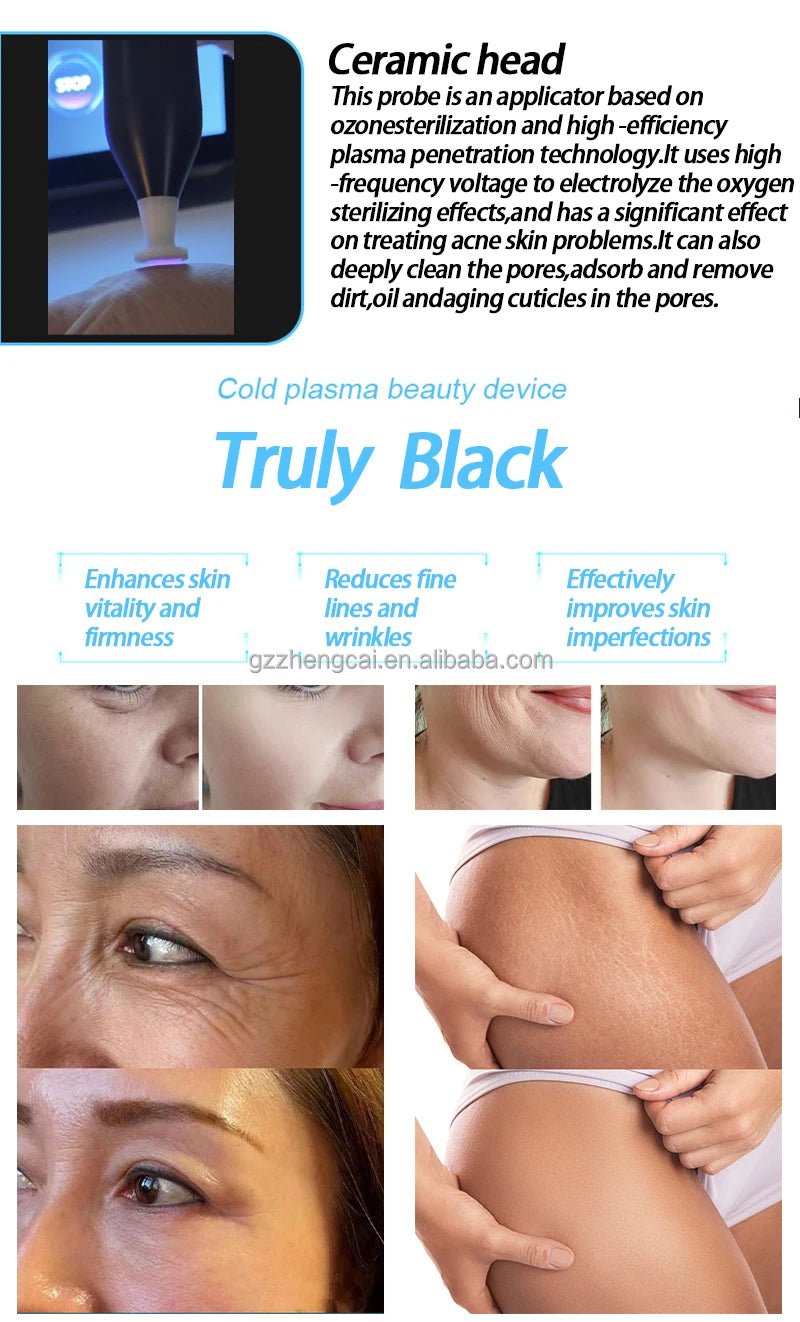 Black cold plasma pen with ceramic head for acne treatment, skin repair, anti-aging, and facial wrinkle reduction.