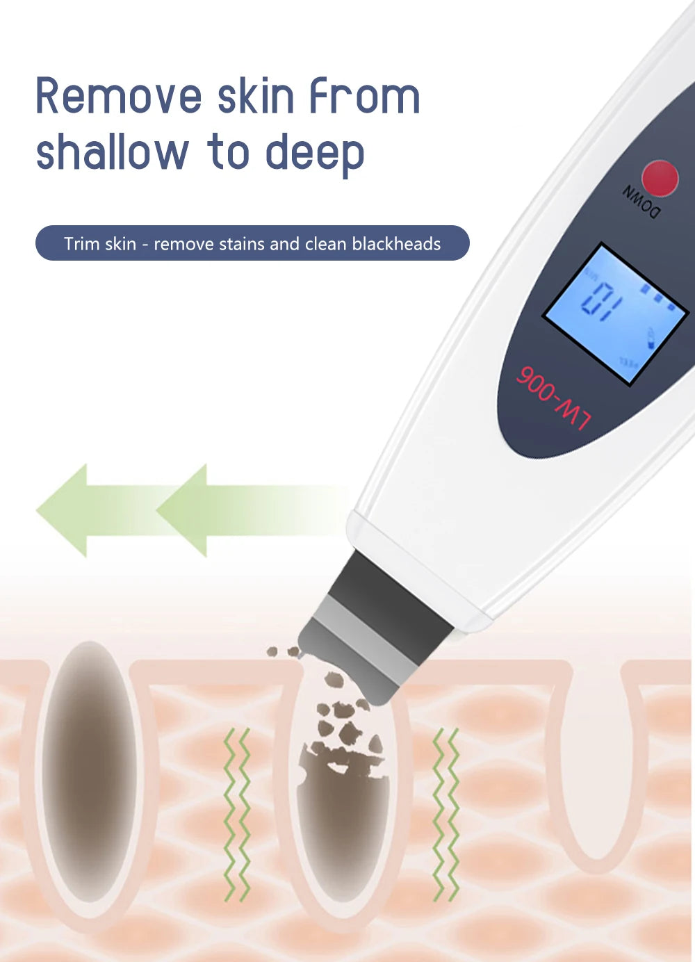 Ultrasonic Skin Scrubber - Professional Deep Pore Cleansing & Lifting Tool Scrubs Treatments Tidesmit
