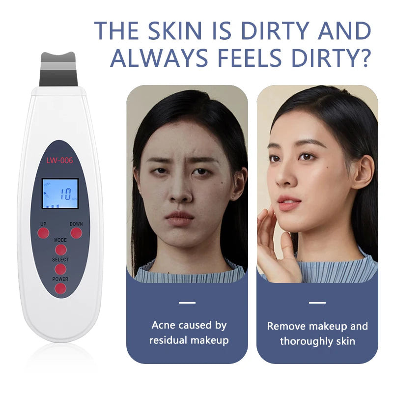 Ultrasonic Skin Scrubber - Professional Deep Pore Cleansing & Lifting Tool Scrubs Treatments Tidesmit