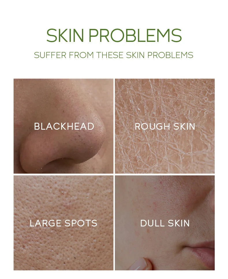 Facial Exfoliating Peeling Gel | Deep Pore Cleansing with Green Tea Scrubs Treatments Tidesmit