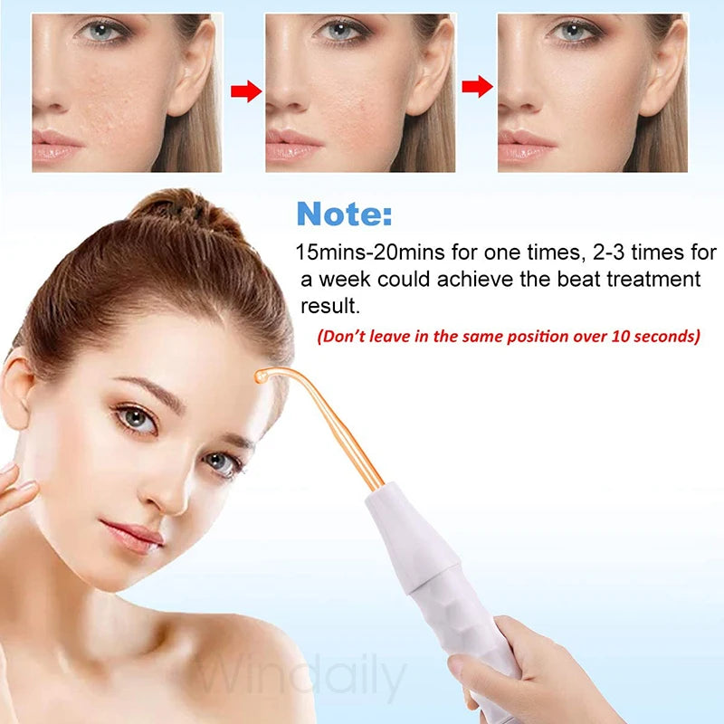 High-frequency facial wand with a curved glass neon electrode, white textured handle, and before-and-after skin results.