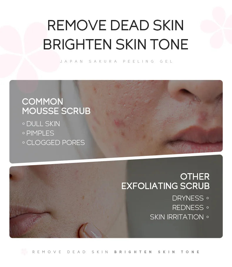 Sakura Exfoliating Face Scrub Gel - Deep Pore Cleanser for Smooth Skin Scrubs Treatments Tidesmit