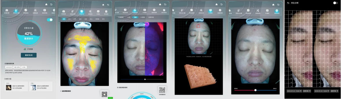 2025 Magic Mirror 3D AI skin analyzer showing facial analysis, hydration levels, and digital dermatological imaging.