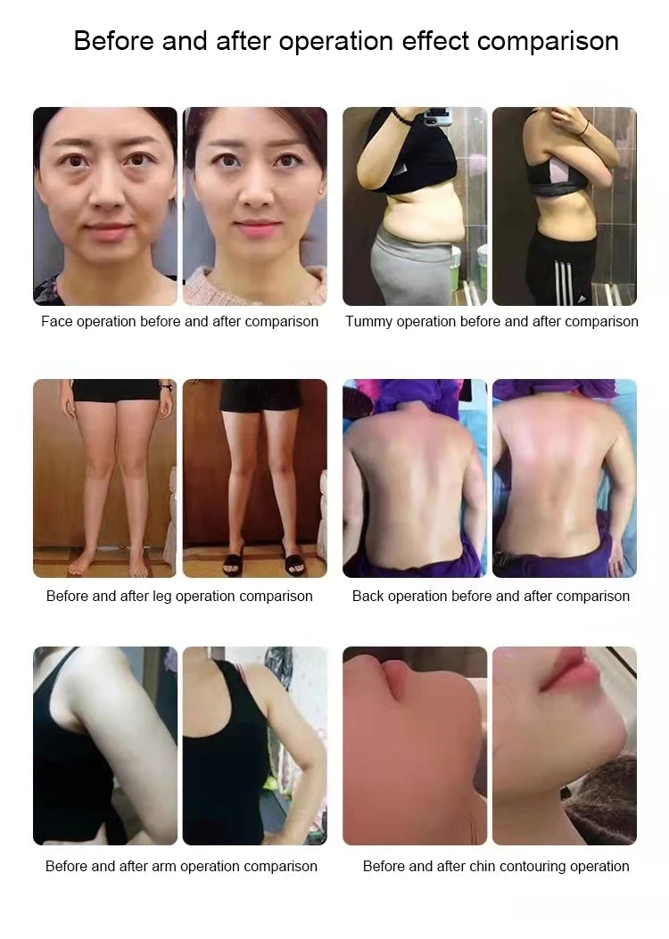 Before and after photos showing results for face, tummy, leg, back, arm, and chin cosmetic procedures.
