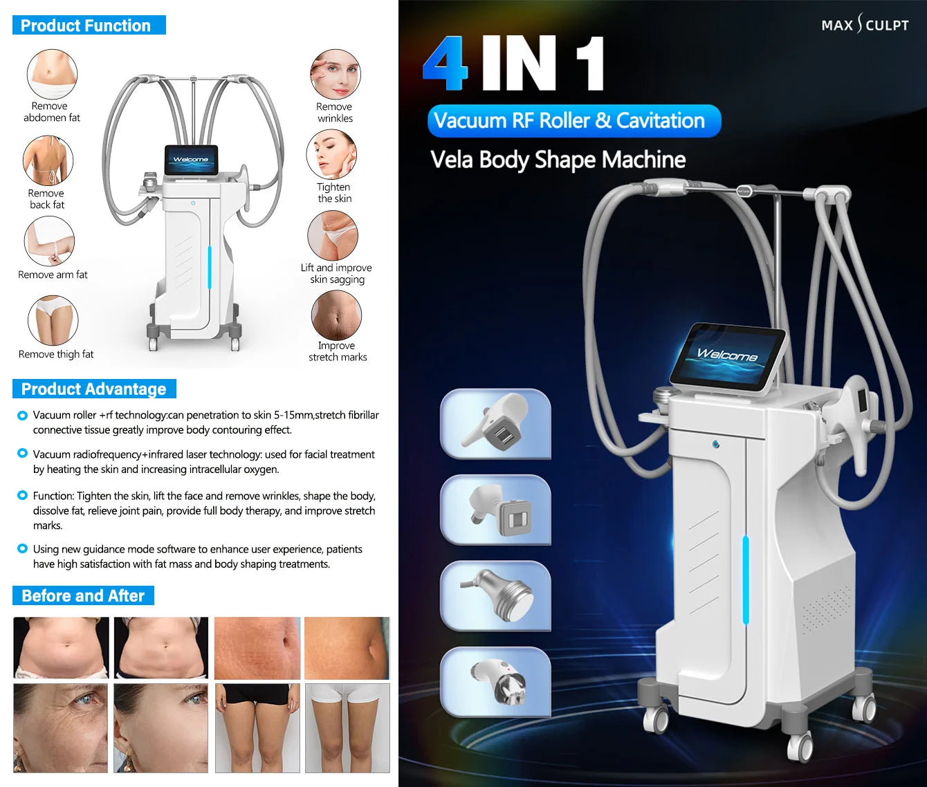 Professional Vacuum Massage Machine | Cellulite Reduction Body Shaper Body Shaping Massage Equipment Tidesmit