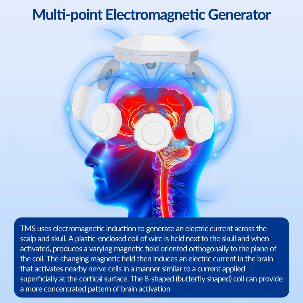 Frovab rTMS brain stimulation device with multi-point electromagnetic coils for non-invasive Parkinson's rehabilitation.