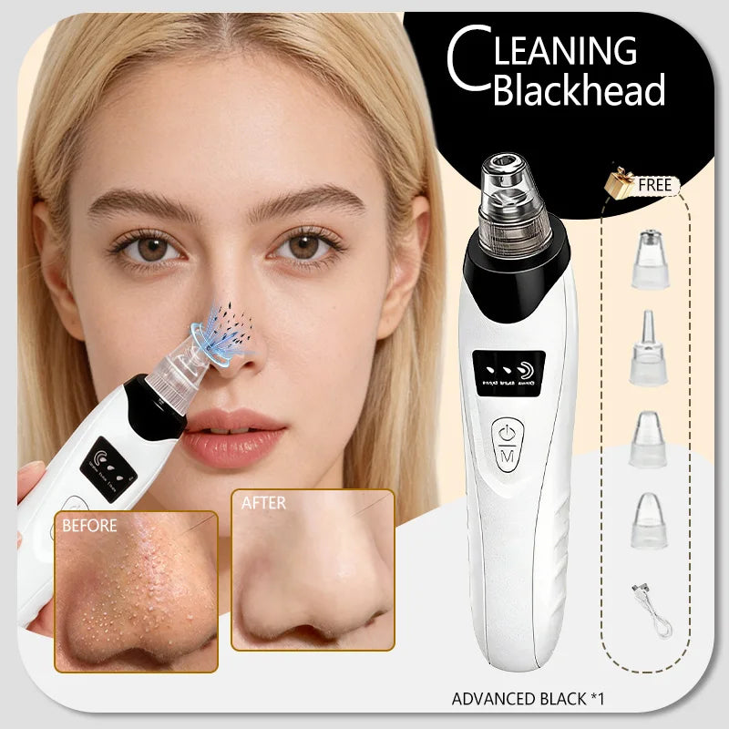 2025 upgraded blackhead remover vacuum, white electric pore cleaner tool with suction heads for acne and nose pores.