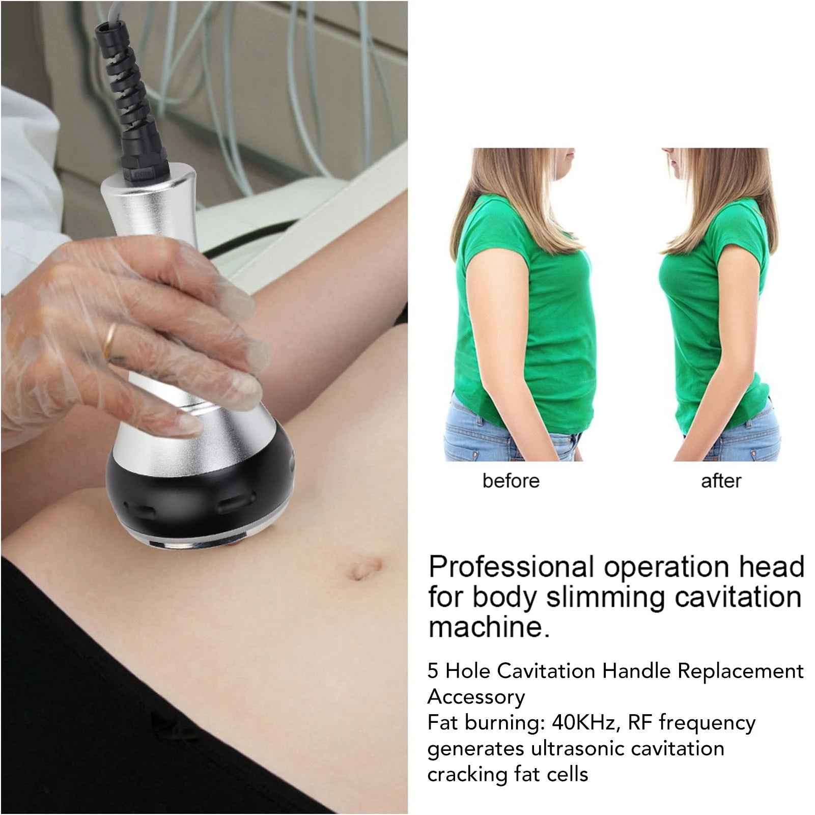 5-hole 40KHz RF ultrasonic cavitation wand replacement head for body slimming and fat burning beauty machine.