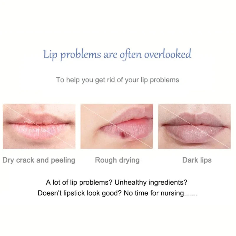 Lip Exfoliating Scrub for Dark Lips – Moisturizing Repair Balm Lip Care Tidesmit