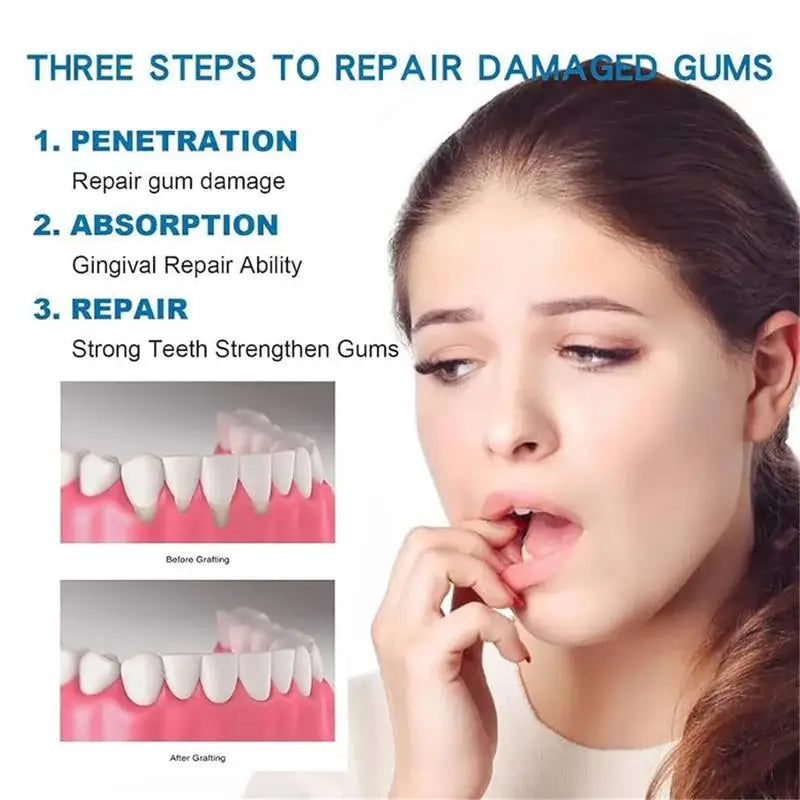 Tidesmit Gum Repair Care teeth whitening gel for gingival health and stain removal