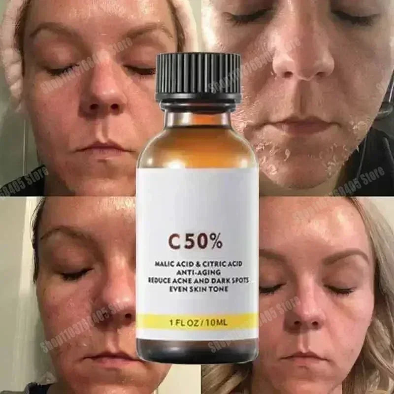 Salicylic Acid Face Peel - Professional Deep Exfoliation & Skin Refinement Scrubs Treatments Tidesmit