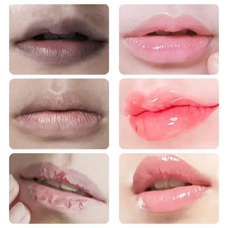 Lip Lightening Balm | Exfoliating & Hydrating Lip Treatment by Tidesmit Lip Care Tidesmit