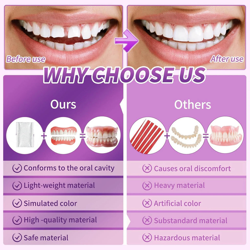Full Natural Silicone Dentures Upper & Lower False Teeth, Comfort Fit Braces, Instant Smile Restoration & Oral Care for Adults