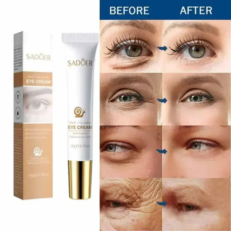 Anti Aging Eye Cream for Dark Circles & Puffiness - Tidesmit EU Scrubs Treatments Tidesmit