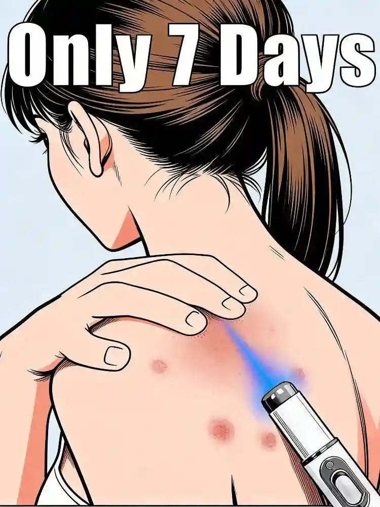 Wart Removal Laser Pen | Blue Light Skin Care & Precision Tool Lip Care Tidesmit