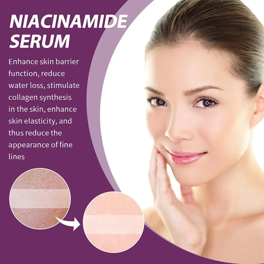 Niacinamide Serum 20% High Concentration Formula Serum Brightens Lightens Spots Niacinamide Care Serum Lifts Nasal Lines