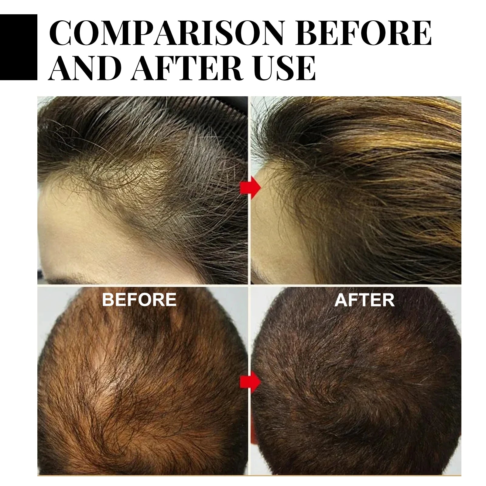 Tidesmit hair growth oil and spray for hair loss, scalp repair, and fast regrowth before and after treatment results.