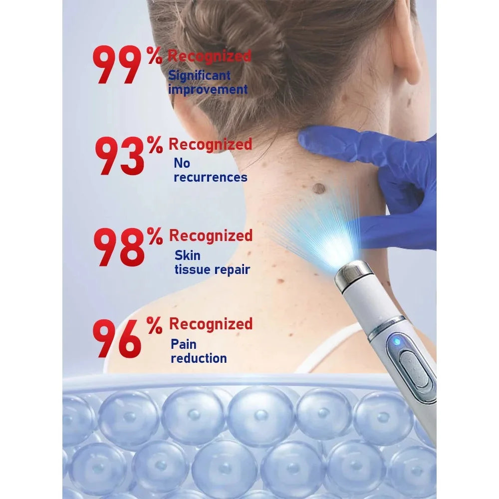 Electric plasma mole removal pen for skin tags, warts, and freckles with light indicator and effective usage statistics.