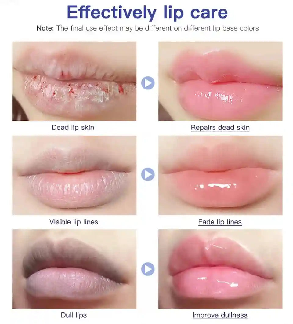 Lip Repair Gel 2pcs - Deep Moisturizing Balm for Dry Lips Lip Care Tidesmit