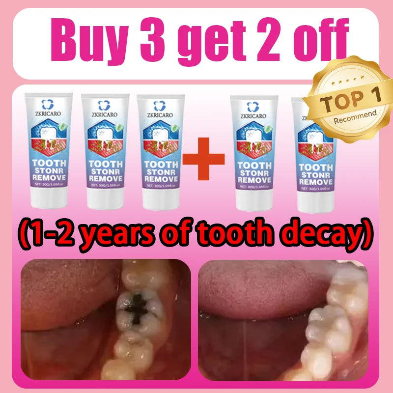 Tooth Decay Repair Treatment | Natural Deep Cleaning & Restorative Formula Scrubs Treatments Buy 3 Get 2 Free Tidesmit
