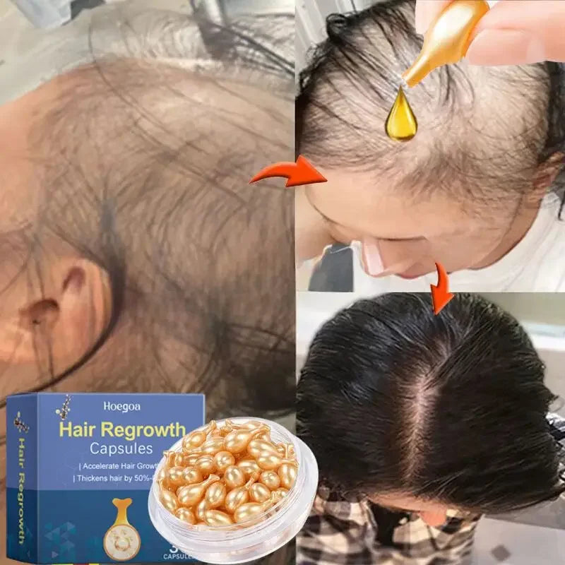 Tidesmit hair growth serum capsules for fast regrowth, anti-hair loss, and damaged scalp repair treatment for women.