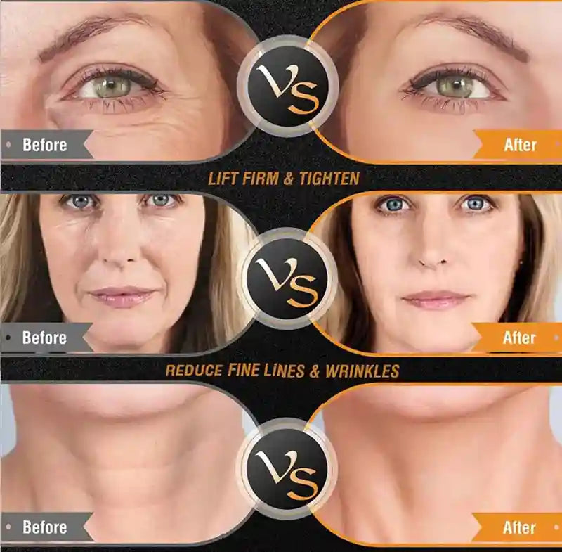 EMS Facial Lifting Device - Professional Skin Tightening & Toning Eye Massage Instrument Tidesmit