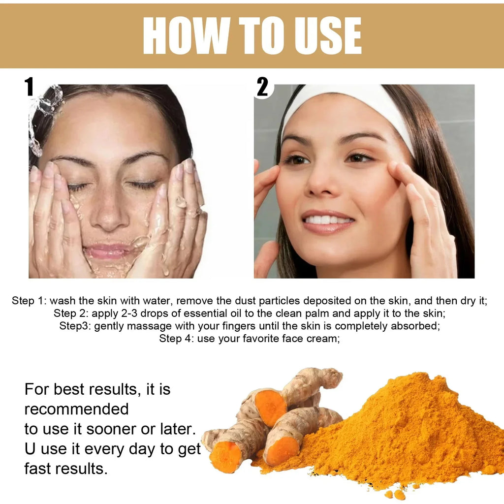 Turmeric Freckle Removing Whitening Essence Fade Pigmentation Melasma Dark Spots Corrector Repair Serum Korean Skin Care