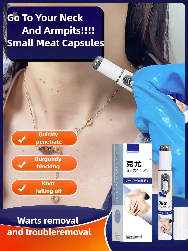 Professional PMU Machine - Precision Skin Tag & Wart Removal Pen Permanent Makeup Machines Tidesmit