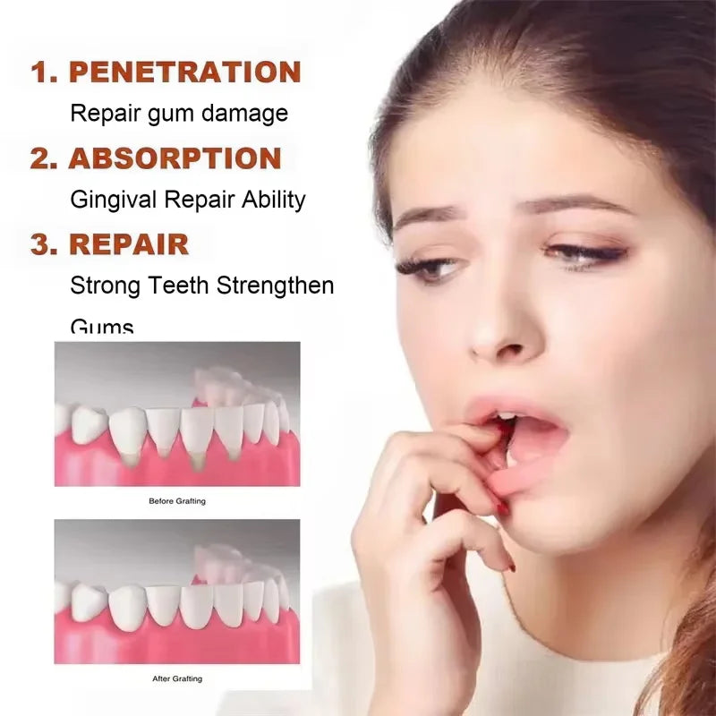 Tidesmit Rapid Soothing Gums Serum for tooth sensitivity, dental caries relief, and professional teeth whitening