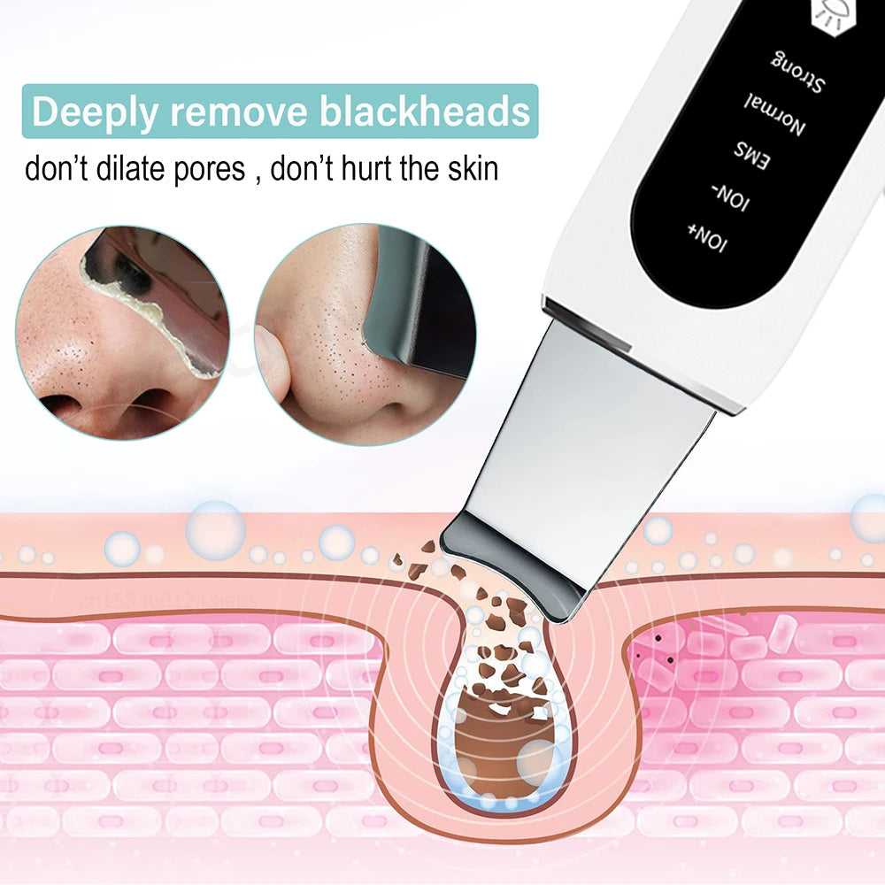 Ultrasonic Skin Scrubber | Professional Facial Cleansing Tool Scrubs Treatments Tidesmit