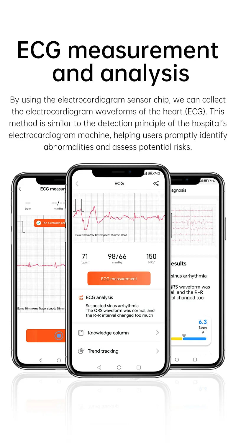 VWAR No Screen Health Smart Bracelet ECG+PPG Blood Pressure Heart Rate Sleep 24h Monitoring Fitness Tracker Smartwatch Men Women