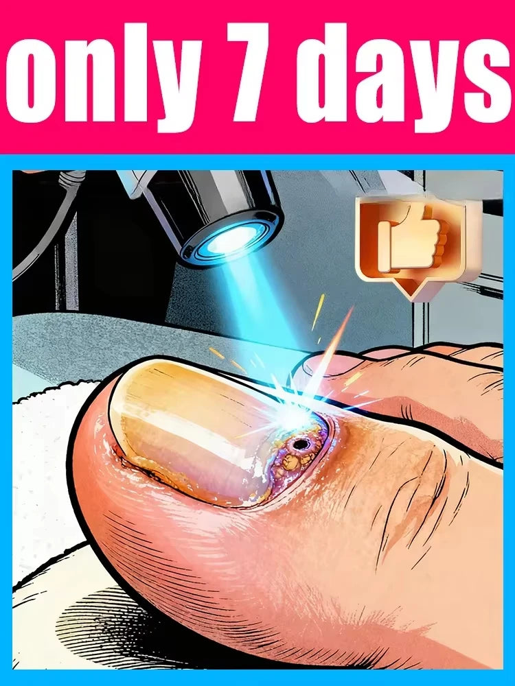 Nail Laser Pen for Onychomycosis - Portable Home Wellness Device Relaxation Treatment Tidesmit