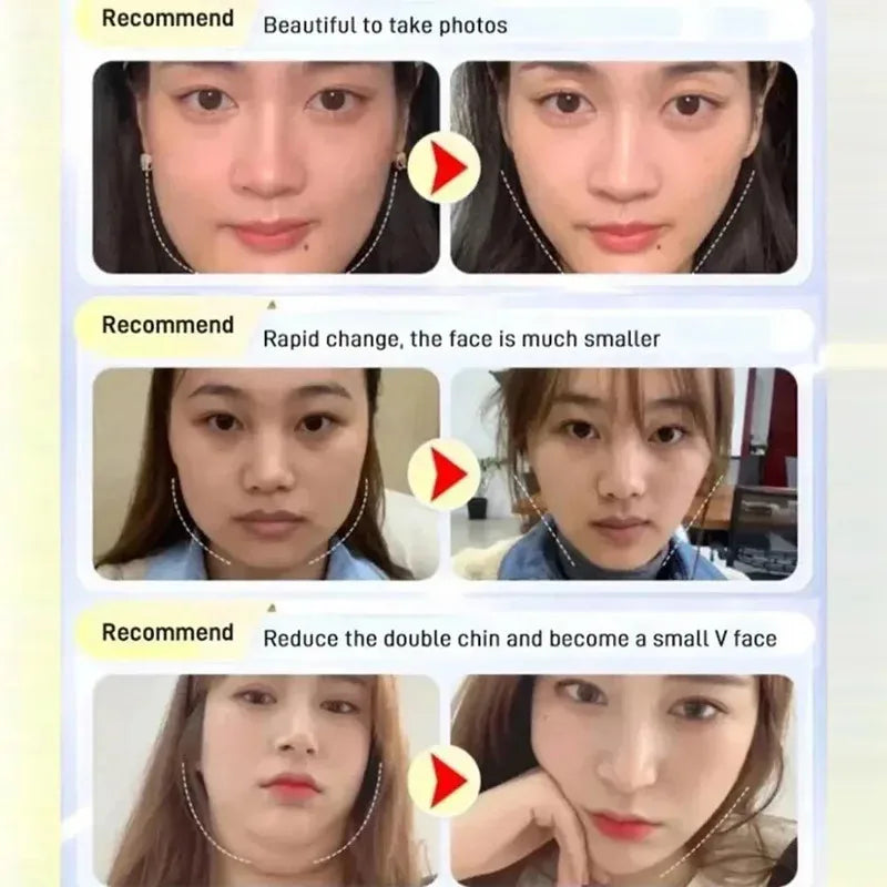 Before and after photos showing facial slimming effects with V-line contouring tools applied to the jawline.