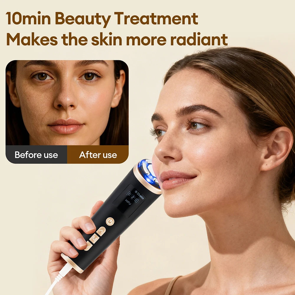 Black, handheld HIFU facial tightening device with gold accents, glowing blue light, and digital display being used.