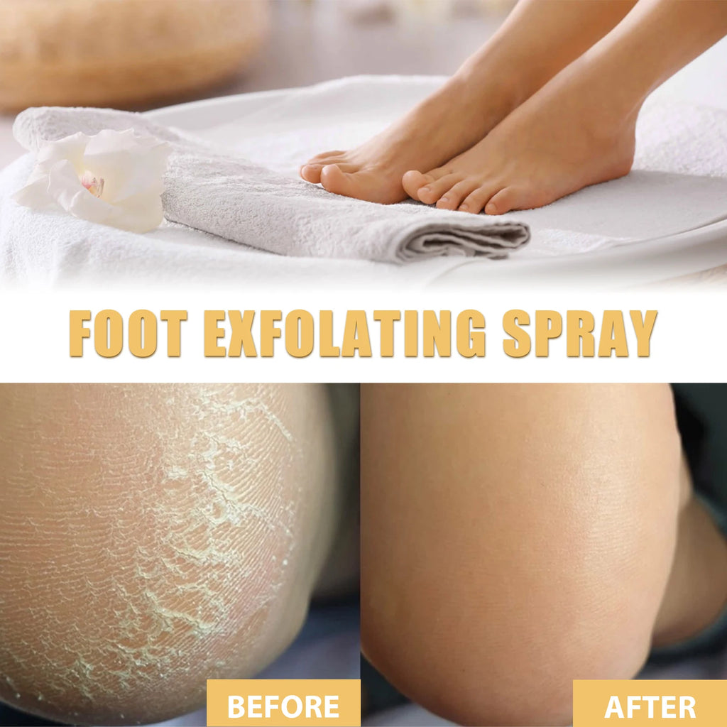 Foot Exfoliating Spray | Professional Callus Remover & Moisture Lock Scrubs Treatments Tidesmit