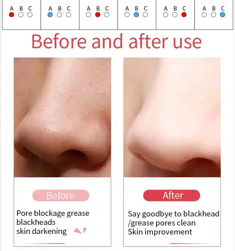 RF Skin Tightener Facial Massager | Ultrasonic Wrinkle Tool with Heat Eye Massage Instrument Tidesmit