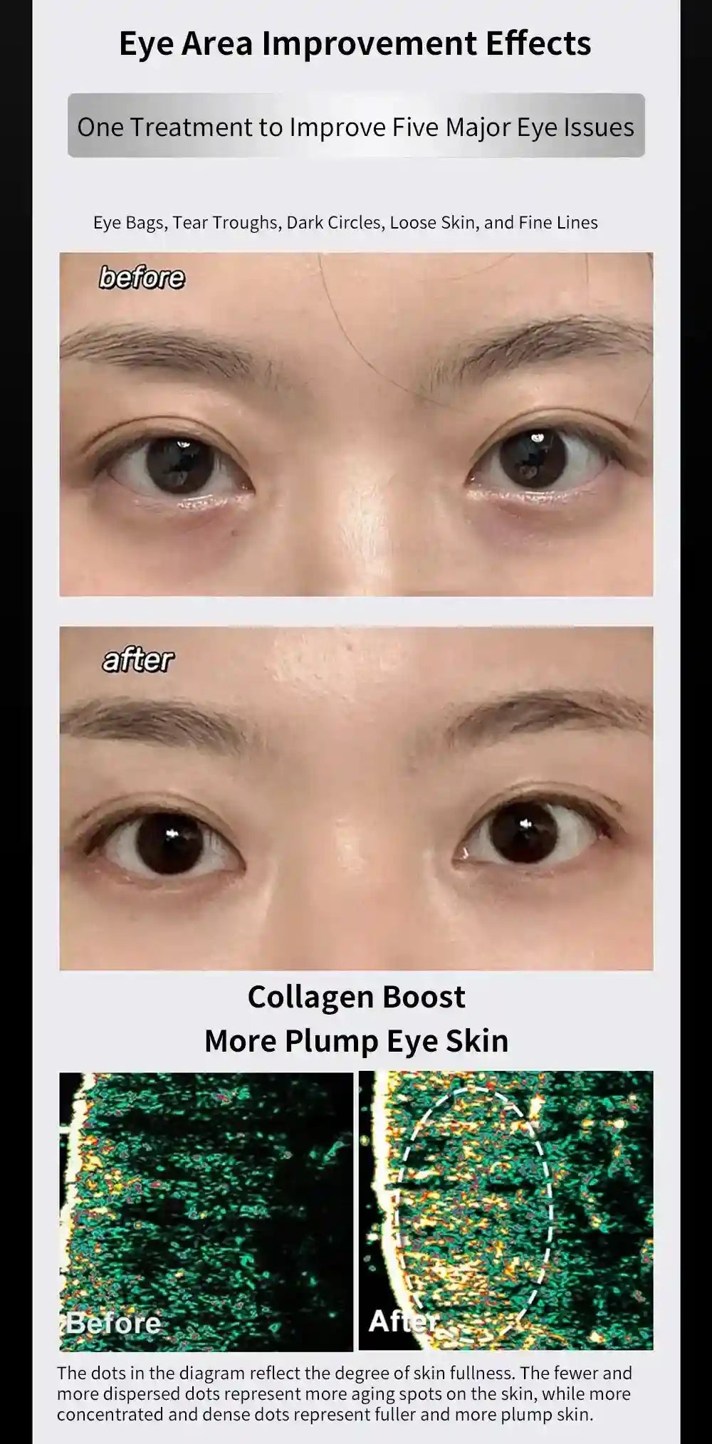 Microcurrent Eye Massager for Facial Lifting and Dark Circles Eye Massage Instrument Tidesmit