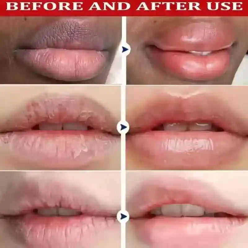 Lip Lightening Balm for Dark Lips - Nourishing 10g Treatment Lip Care Tidesmit