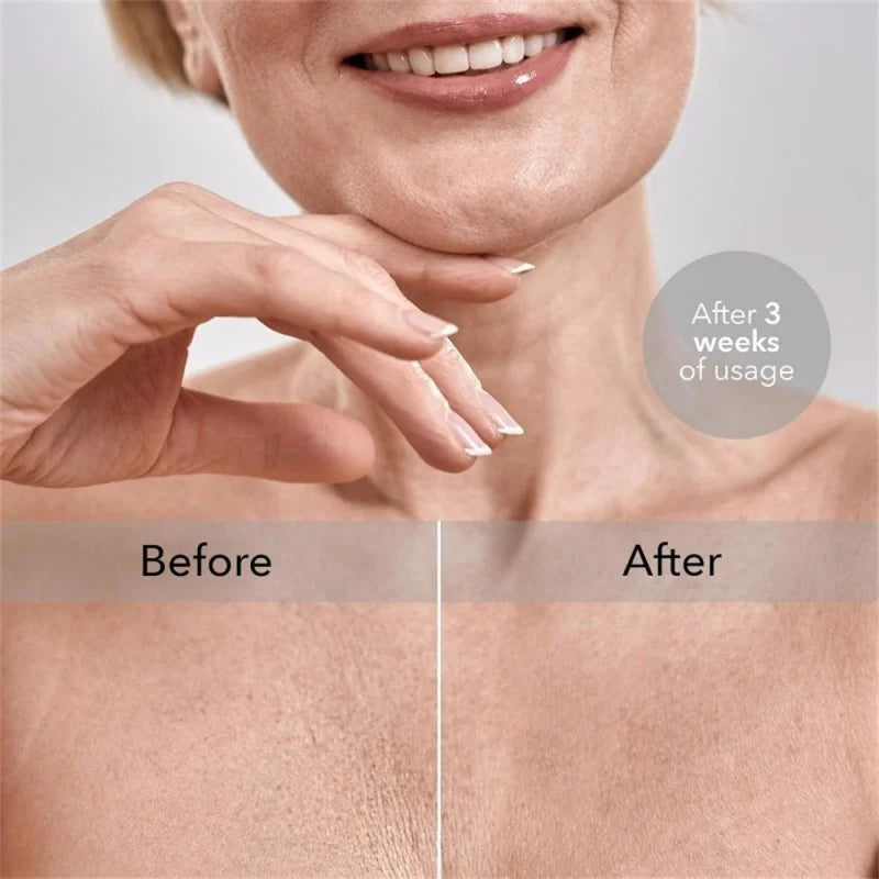 Chest Wrinkle Pad for Sleeping - Anti-Aging Decollete Support Massage Cushion Tidesmit