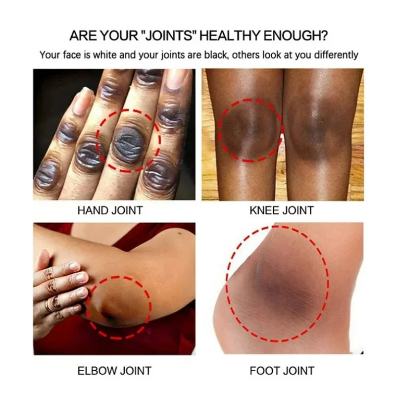 Remove Melanin Nicotinamide Brightening Cream For Dark Skin Effective Lighten Thigh Inner Bleach Private Parts Brighten Cream
