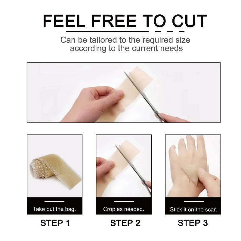 Beige silicone scar sheets roll being cut with scissors and applied to skin for scar and stretch mark treatment.