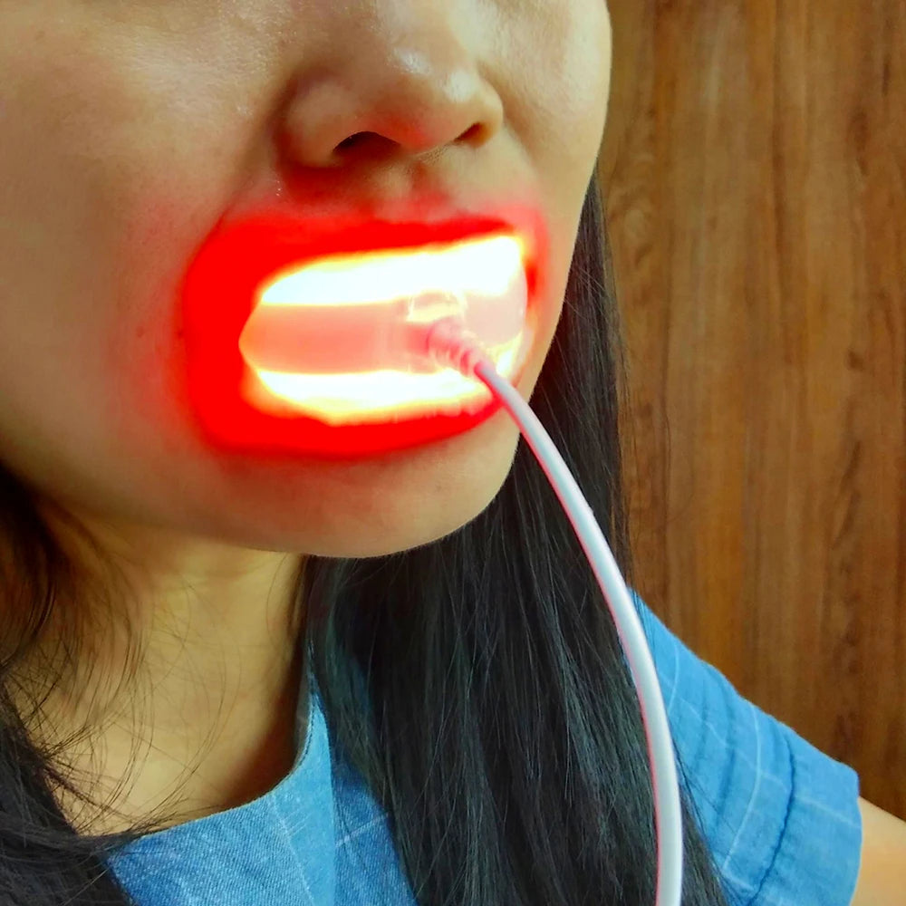 Gum Disease Red Light Therapy Device - HLKGO-USBO3 Oral Wellness Relaxation Treatment HLKGO-USBO3 Tidesmit