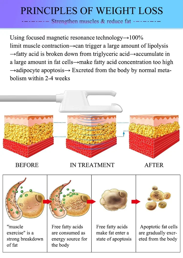 HIEMT EMS body sculpting machine diagram showing fat reduction and muscle building process on skin layers.
