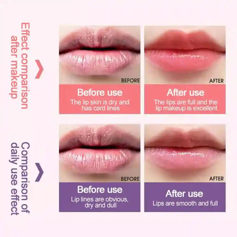 Lip Sleeping Mask – Hydrating Night Moisturizer | Tidesmit Lip Care Tidesmit