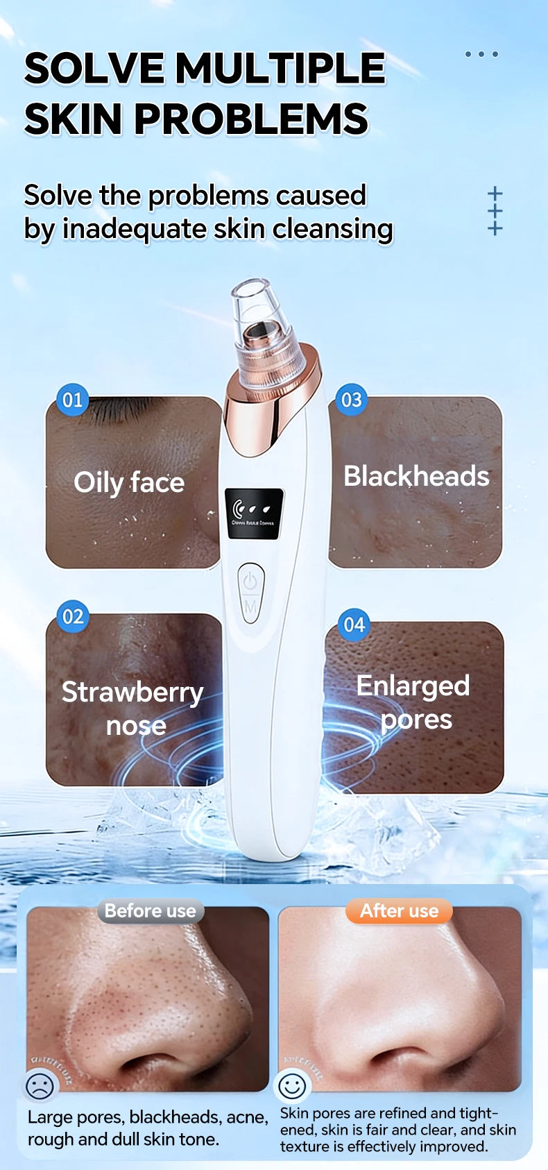 White and rose gold handheld electric pore vacuum for removing blackheads and clearing skin.